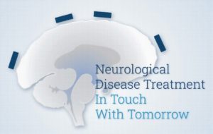 Read more about the article 腦顳葉干涉刺激設備上市了!