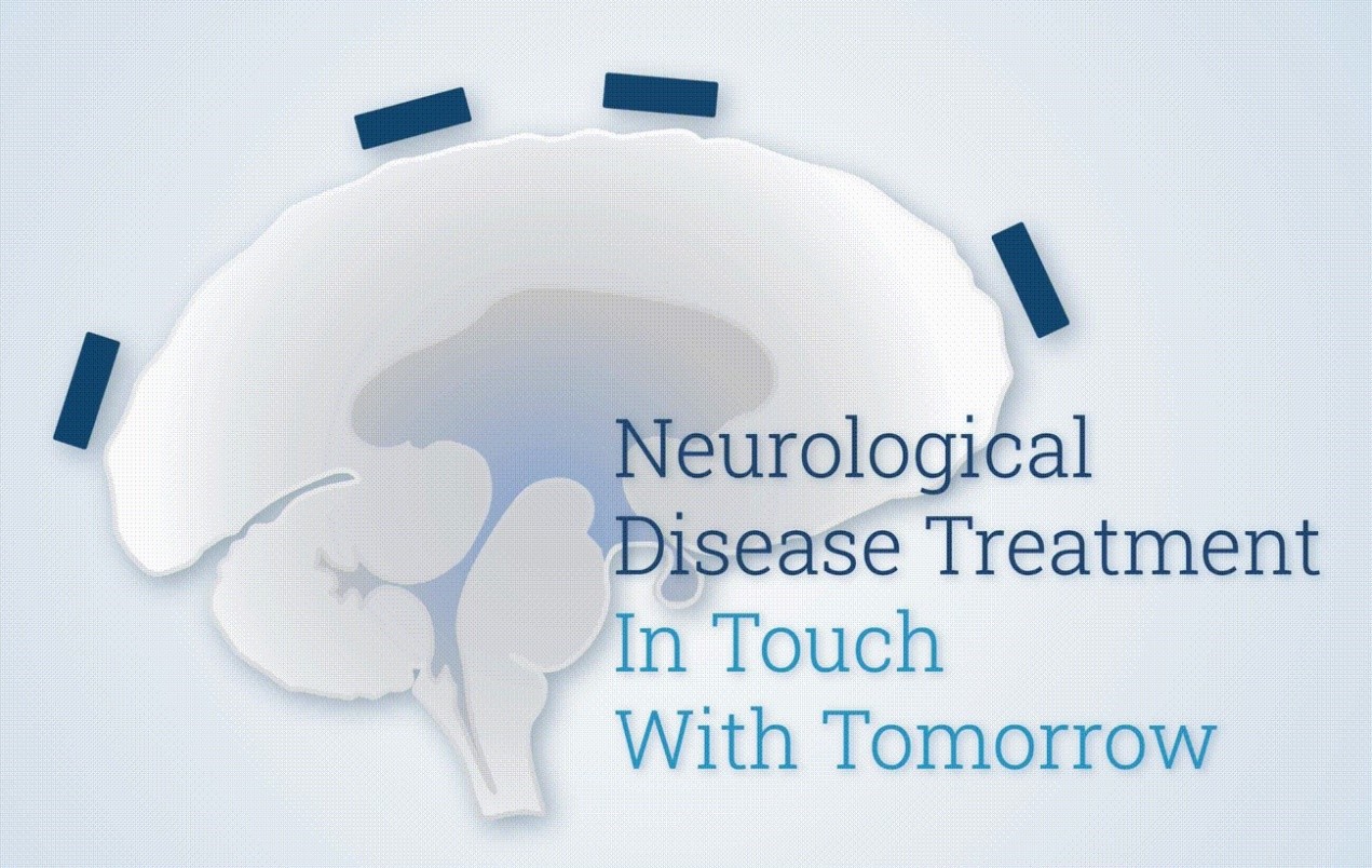 Read more about the article 脑颞叶干涉刺激设备上市了!