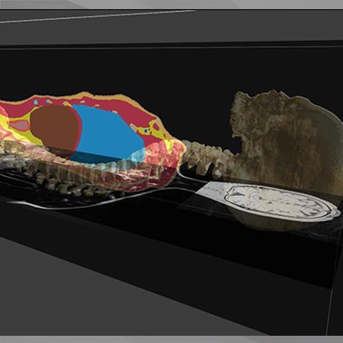 Read more about the article Medical Image Segmentation Tool Set:iSEG