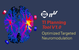 Read more about the article TI Planning Tool V1.0