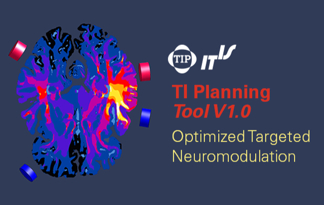 Read more about the article TI Planning Tool V1.0 –深脑刺激的规划工具